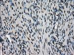 Ki67 Antibody in Immunohistochemistry (Paraffin) (IHC (P))