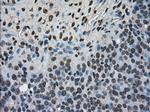 Ki67 Antibody in Immunohistochemistry (Paraffin) (IHC (P))