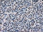 Ki67 Antibody in Immunohistochemistry (Paraffin) (IHC (P))