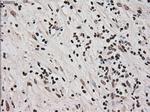 Ki67 Antibody in Immunohistochemistry (Paraffin) (IHC (P))