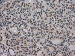 Ki67 Antibody in Immunohistochemistry (Paraffin) (IHC (P))