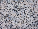 Ki67 Antibody in Immunohistochemistry (Paraffin) (IHC (P))