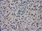 Ki67 Antibody in Immunohistochemistry (Paraffin) (IHC (P))