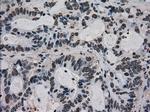 Ki67 Antibody in Immunohistochemistry (Paraffin) (IHC (P))