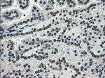 Ki67 Antibody in Immunohistochemistry (Paraffin) (IHC (P))