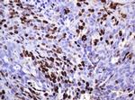 Ki67 Antibody in Immunohistochemistry (Paraffin) (IHC (P))