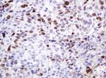 Ki67 Antibody in Immunohistochemistry (Paraffin) (IHC (P))