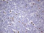 Ki67 Antibody in Immunohistochemistry (Paraffin) (IHC (P))