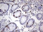 Ki67 Antibody in Immunohistochemistry (Paraffin) (IHC (P))