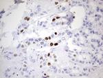 Ki67 Antibody in Immunohistochemistry (Paraffin) (IHC (P))