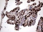 Ki67 Antibody in Immunohistochemistry (Paraffin) (IHC (P))