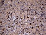 Ki67 Antibody in Immunohistochemistry (Paraffin) (IHC (P))