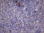 Ki67 Antibody in Immunohistochemistry (Paraffin) (IHC (P))