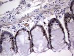 Ki67 Antibody in Immunohistochemistry (Paraffin) (IHC (P))