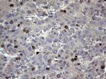 Ki67 Antibody in Immunohistochemistry (Paraffin) (IHC (P))