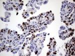 Ki67 Antibody in Immunohistochemistry (Paraffin) (IHC (P))