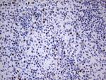 Ki67 Antibody in Immunohistochemistry (Paraffin) (IHC (P))