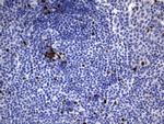 Ki67 Antibody in Immunohistochemistry (Paraffin) (IHC (P))