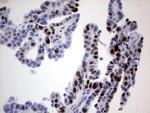 Ki67 Antibody in Immunohistochemistry (Paraffin) (IHC (P))