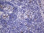 Ki67 Antibody in Immunohistochemistry (Paraffin) (IHC (P))