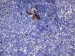 Ki67 Antibody in Immunohistochemistry (Paraffin) (IHC (P))