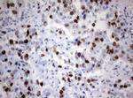 Ki67 Antibody in Immunohistochemistry (Paraffin) (IHC (P))