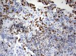 Ki67 Antibody in Immunohistochemistry (Paraffin) (IHC (P))