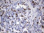 Ki67 Antibody in Immunohistochemistry (Paraffin) (IHC (P))