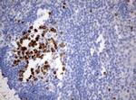 Ki67 Antibody in Immunohistochemistry (Paraffin) (IHC (P))