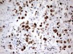 Ki67 Antibody in Immunohistochemistry (Paraffin) (IHC (P))