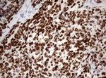 Ki67 Antibody in Immunohistochemistry (Paraffin) (IHC (P))