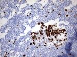Ki67 Antibody in Immunohistochemistry (Paraffin) (IHC (P))