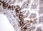 Ki67 Antibody in Immunohistochemistry (Paraffin) (IHC (P))