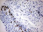 Ki67 Antibody in Immunohistochemistry (Paraffin) (IHC (P))