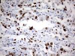 Ki67 Antibody in Immunohistochemistry (Paraffin) (IHC (P))