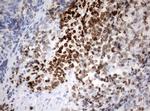 Ki67 Antibody in Immunohistochemistry (Paraffin) (IHC (P))