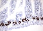 Ki67 Antibody in Immunohistochemistry (Paraffin) (IHC (P))