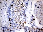 Ki67 Antibody in Immunohistochemistry (Paraffin) (IHC (P))