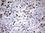 Ki67 Antibody in Immunohistochemistry (Paraffin) (IHC (P))