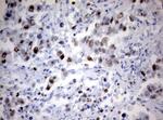 Ki67 Antibody in Immunohistochemistry (Paraffin) (IHC (P))