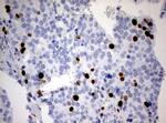 Ki67 Antibody in Immunohistochemistry (Paraffin) (IHC (P))