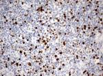 Ki67 Antibody in Immunohistochemistry (Paraffin) (IHC (P))