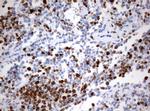 Ki67 Antibody in Immunohistochemistry (Paraffin) (IHC (P))