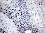 Ki67 Antibody in Immunohistochemistry (Paraffin) (IHC (P))