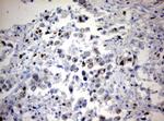 Ki67 Antibody in Immunohistochemistry (Paraffin) (IHC (P))