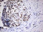 Ki67 Antibody in Immunohistochemistry (Paraffin) (IHC (P))