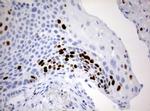 Ki67 Antibody in Immunohistochemistry (Paraffin) (IHC (P))