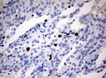 Ki67 Antibody in Immunohistochemistry (Paraffin) (IHC (P))