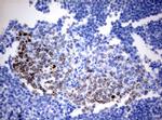 Ki67 Antibody in Immunohistochemistry (Paraffin) (IHC (P))