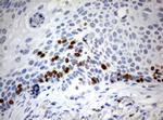 Ki67 Antibody in Immunohistochemistry (Paraffin) (IHC (P))